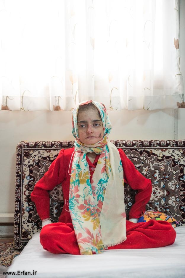 دیدار حضرت استاد انصاریان از بیماران پروانه ای در خانه "ای بی"+تصاویر